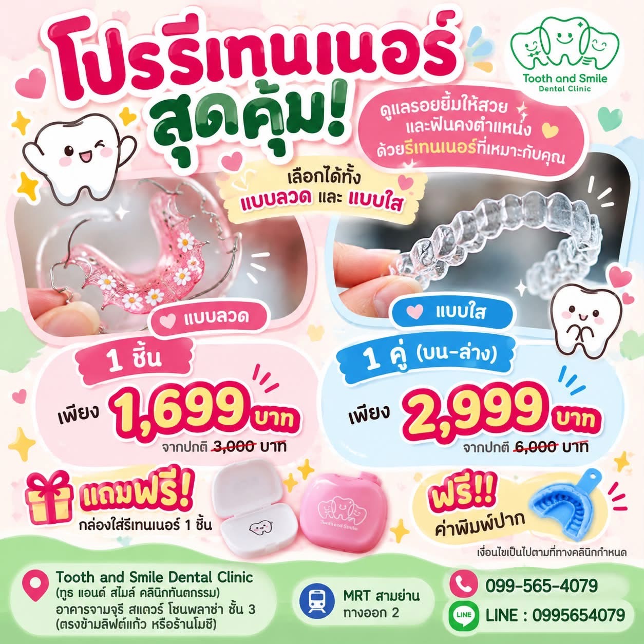 โปรโมชั่นรีเทนเนอร์แบบลวดและแบบใส